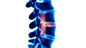 Léčba bolesti zad - Centrum pohybové medicíny Nandana